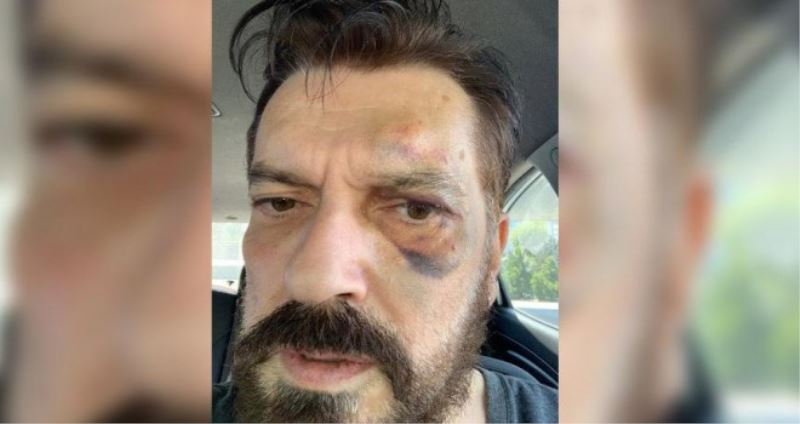 SONAR Araştırma Şirketi’nin sahibi Hakan Bayrakçı’ya çirkin saldırı